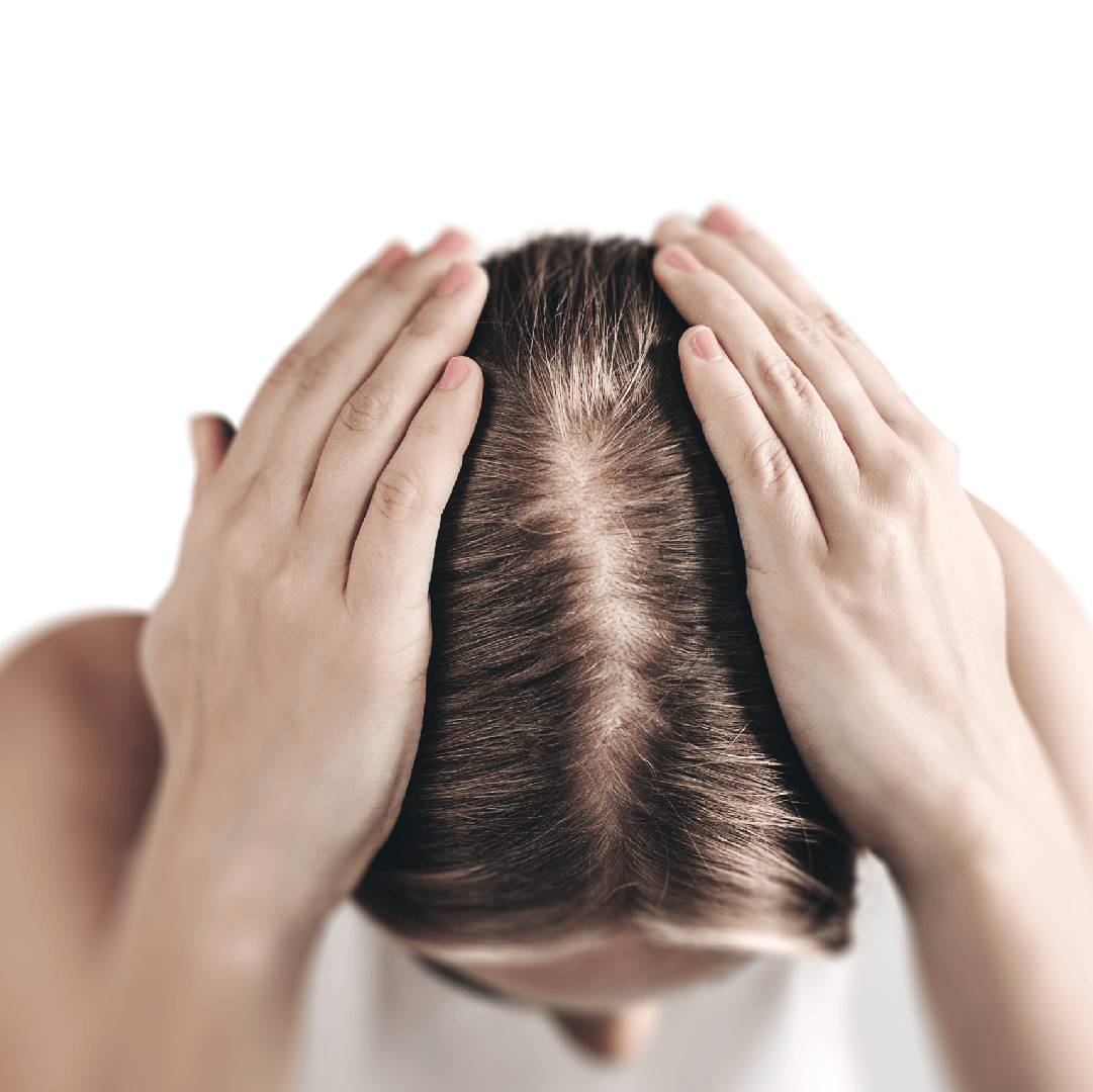 Hair loss: Causes, Treatment & Prevention | AROMASE