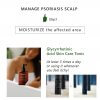 AROMASE-Psoriasis skin scalp tonic-06