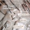 AROMASE dry scalp soothing shampoo for dry dandruff, dry itchy hair (4) dry dandruff looks like