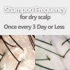 AROMASE dry scalp soothing shampoo for dry dandruff, dry itchy hair (5)