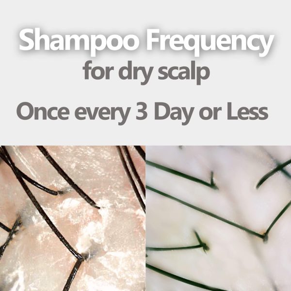 AROMASE dry scalp soothing shampoo for dry dandruff, dry itchy hair (5)