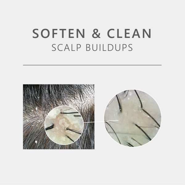 AROMASE-juniper-amz-scalp deep clean-herb-soften