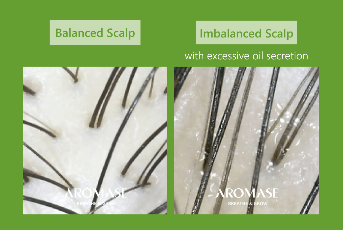 AROMASE oily scalp and dry ends_scalp care_what does it look like