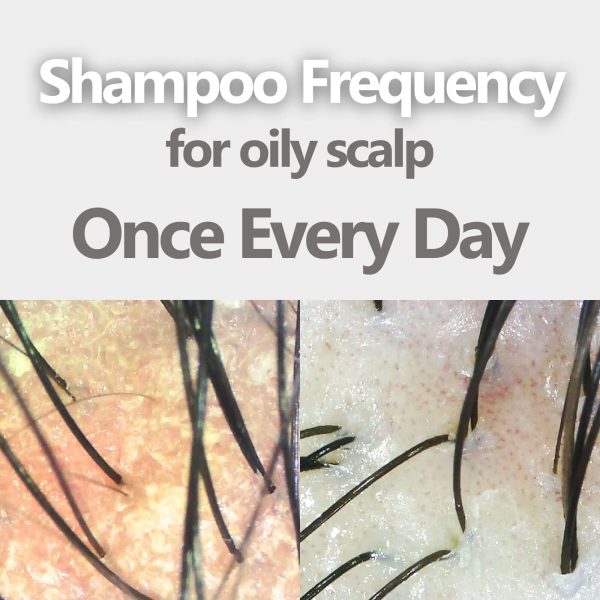 AROMASE oily scalp balancing shampoo for oily dandruff, greasy hair, itchy scalp, itchy hair (3)