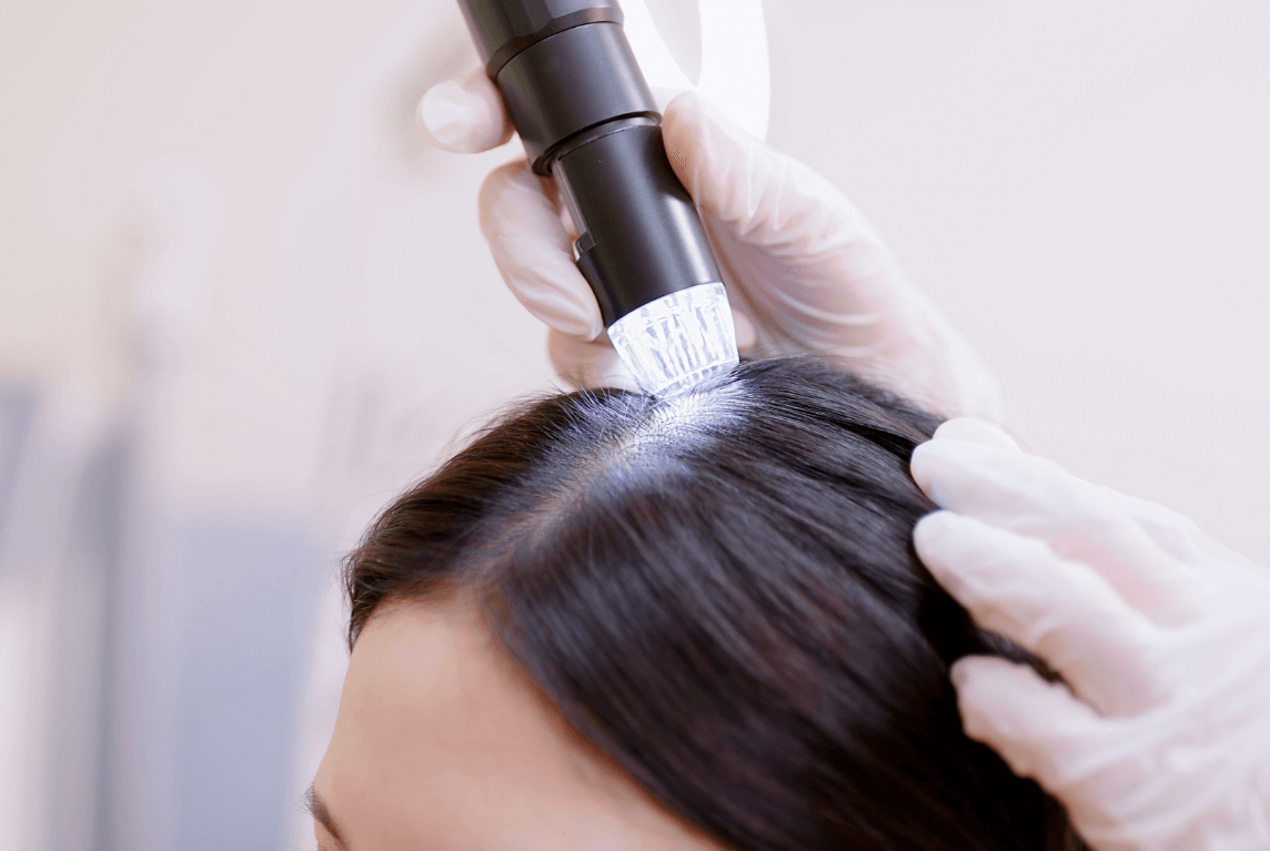 AROMASE scalp oily solution