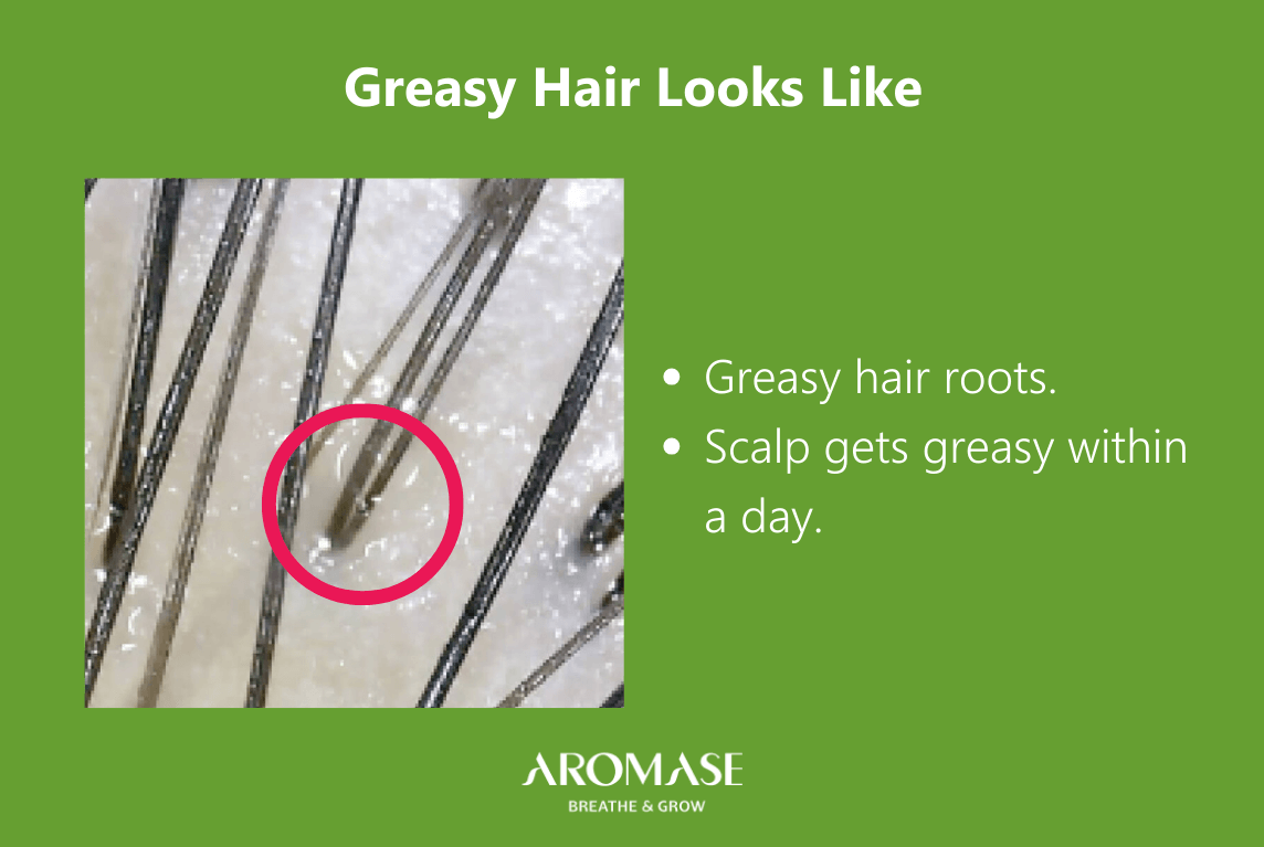 AROMASE_scalp care_The diffrence between Oily Hair and Oily Dandruff (2) oily hair looks like