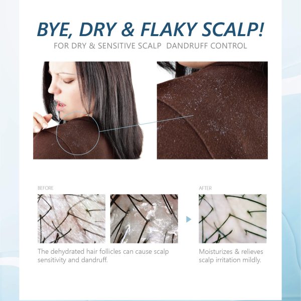 Dry Sensitive scalp shampoo (2)