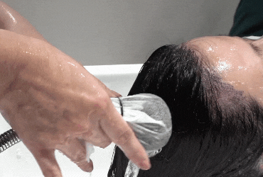 MediPRO-AROMASE-Scalp care after hair transplant (370 × 250 px) (1)