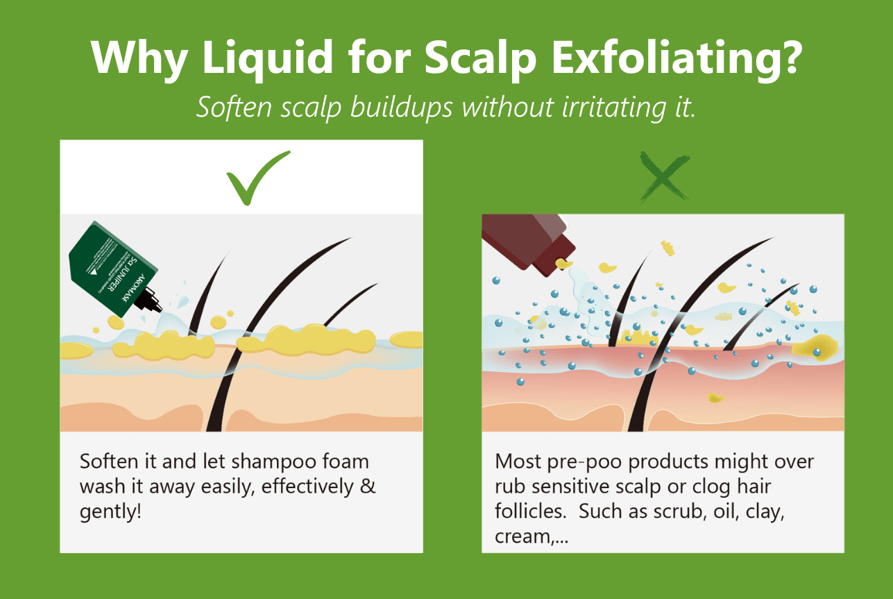 Why Liquid for Scalp Exfoliating AROMASE_scalp dandruff greasy oily flaky treatment scalp itchy